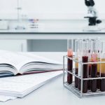 Blutprobenröhrchen im Labor - Nachweis von Glutensensitivität durch Bluttest