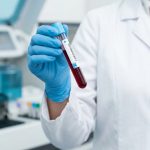 Arzt hält Blutröhrchen für Zöliakie-Antikörpertest im Labor